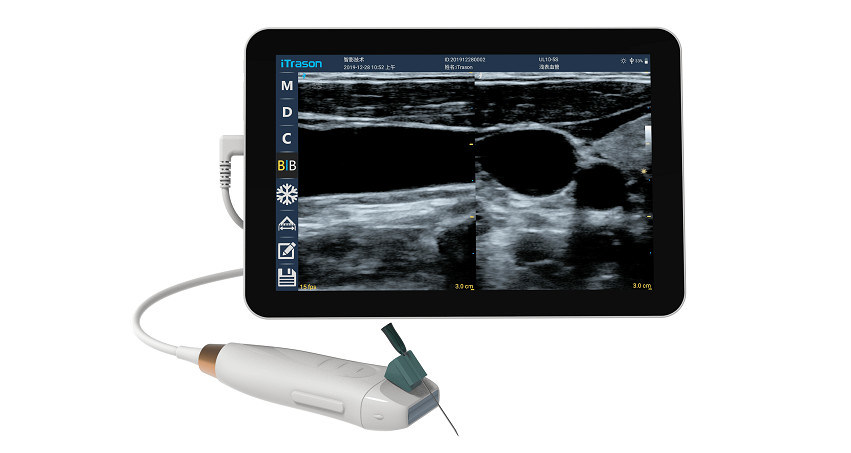 Handheld Ultraschall-Scanner mit 12MHZ-Hochfrequenz-Linearsonde für genauen Gefäßzugriff und PICC-Einsatzverfahren