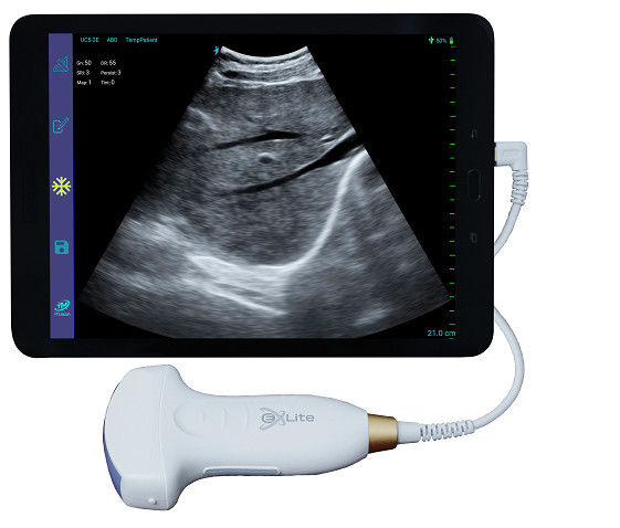 Elektronische konvexe Reihen-Farb-Doppler-Handultraschall-Scanner 3.5MHz