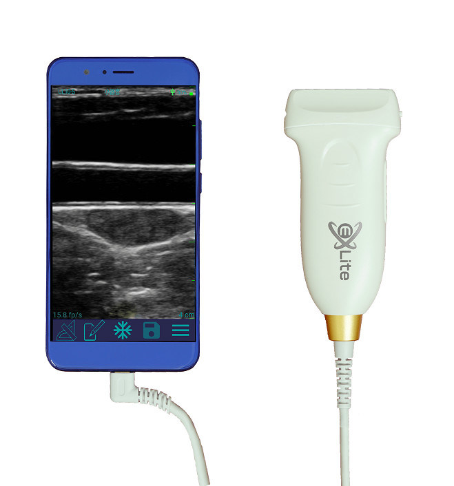 USB Typ-C Linearer Hand-Ultraschallscanner 10 MHz Tragbare Android-Ultraschallsonde für Gefäß- und POCUS-Geräte