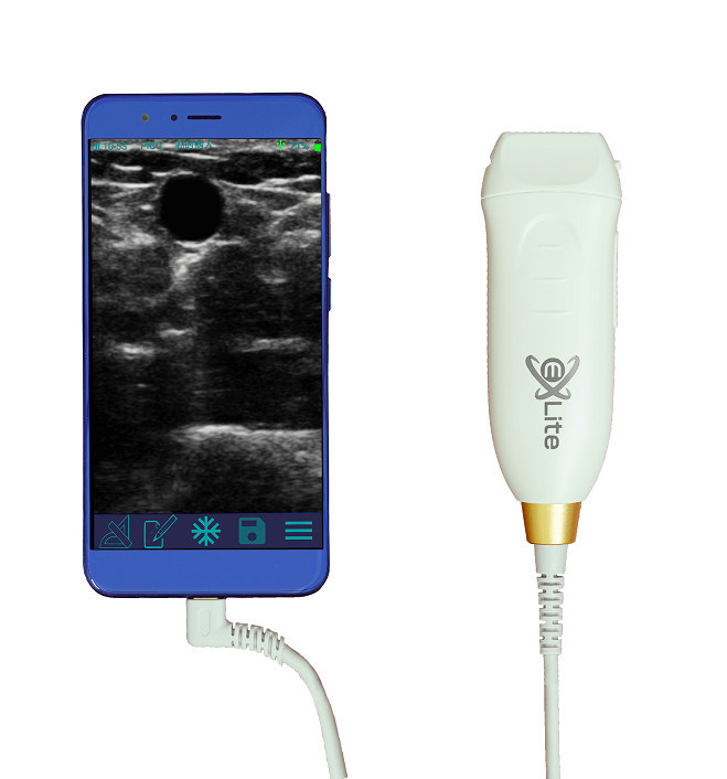 Handheld Ultraschall-Scanner mit 12MHZ-Hochfrequenz-Linearsonde für genauen Gefäßzugriff und PICC-Einsatzverfahren