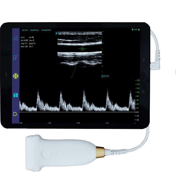 tragbarer drahtloser Android Ultraschall-Scanner 10MHz mit Art-c Verbindung
