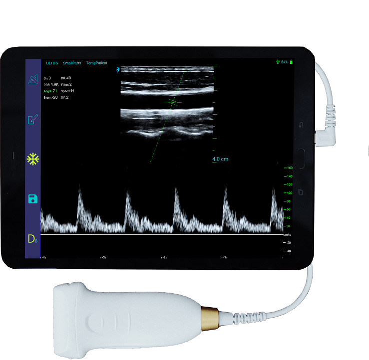 USB Typ-C Linearer Hand-Ultraschallscanner 10 MHz Tragbare Android-Ultraschallsonde für Gefäß- und POCUS-Geräte