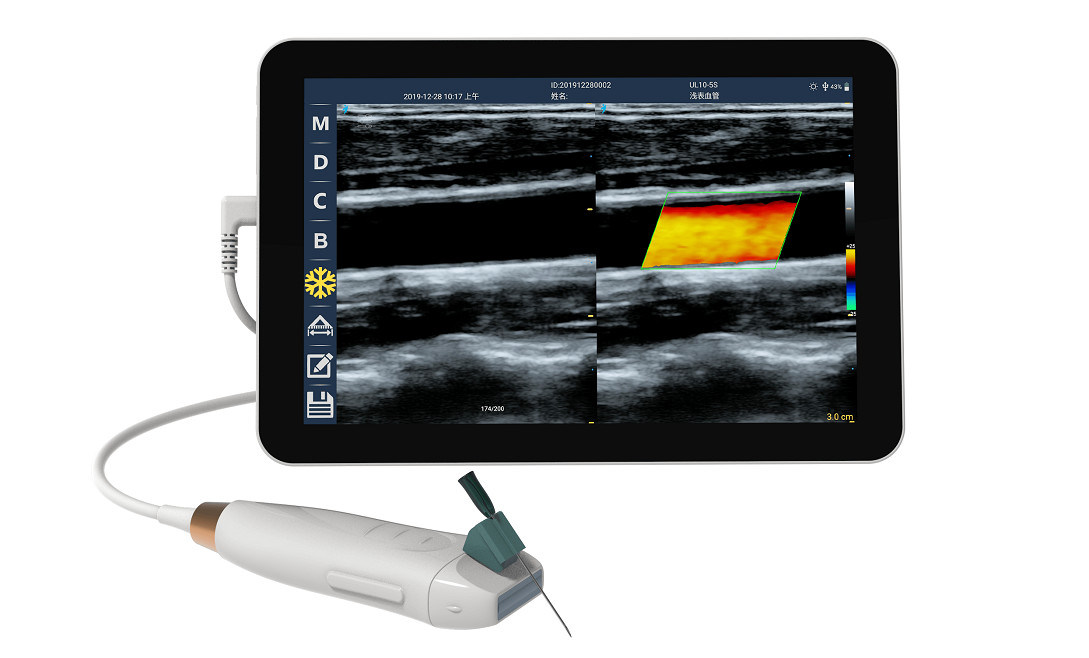 Handheld Ultraschall-Scanner mit 12MHZ-Hochfrequenz-Linearsonde für genauen Gefäßzugriff und PICC-Einsatzverfahren