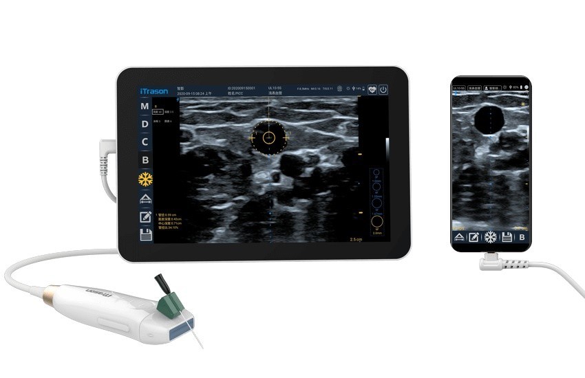 64 Kanal 20mm Tiefe Handheld Ultraschall-Scanner für periphere vaskuläre Beurteilung und Ultraschall-geführte vaskuläre Zugang