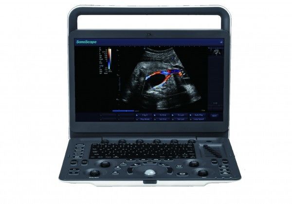 7 tragbare Ultraschall-Maschine Darstellungs-Niveaus SonoScape E3 mit dem 15,6 Zoll-Monitor