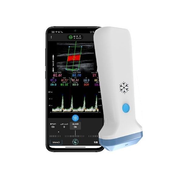 12.6cm tragbarer Farb-Doppler-Ultraschall-Scanner für Heilberufler
