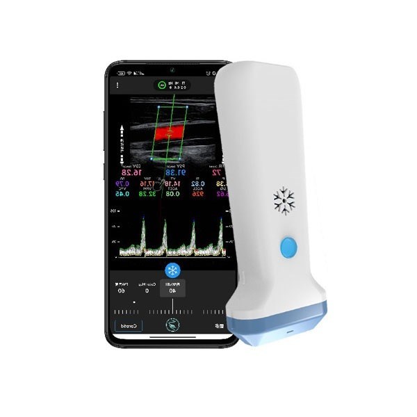 Tragbarer, kabelloser, linearer Farbdoppler-Ultraschallscanner, 12,6 cm, tragbarer POCUS-Ultraschall für medizinisches Fachpersonal