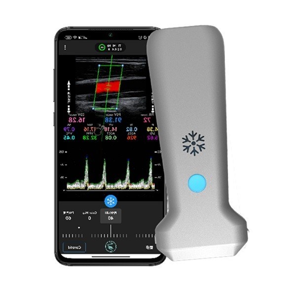 CE-zertifizierter kabelloser linearer Hand-Ultraschallscanner | Tragbare 8,3-MHz-Farbdoppler-Ultraschallsonde
