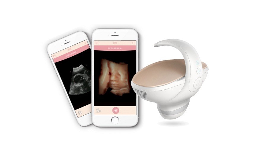 CE zugelassener 3D/4D-Handheld-Fetal-Ultraschallscanner
Tragbare Schwangerschaftsbildlösung mit 60° Breitwinkel-Konvexprobe