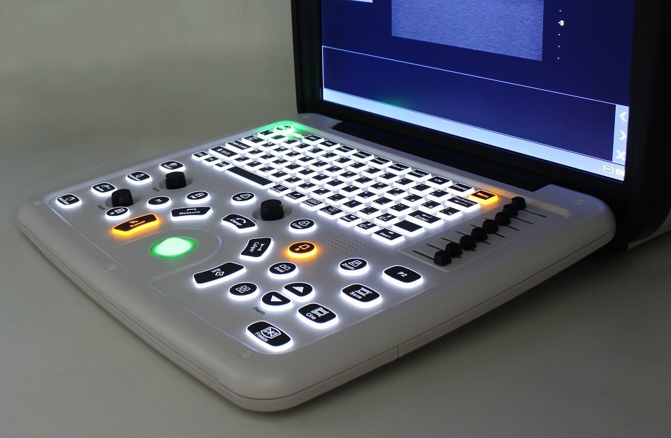Tragbares Farbdoppler-Ultraschallsystem DCU10 mit 15-Zoll-HD-Display für Geburtshilfe/Gynäkologie, Bauch- und Herzbildgebung