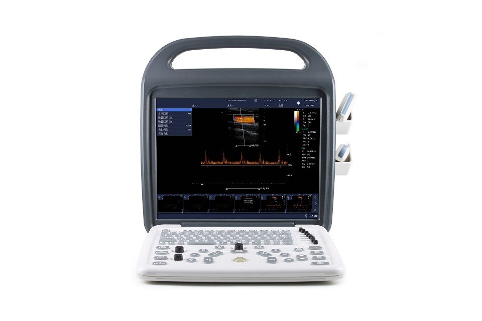 Tragbares Farbdoppler-Ultraschallsystem DCU10 mit 15-Zoll-HD-Display für Geburtshilfe/Gynäkologie, Bauch- und Herzbildgebung