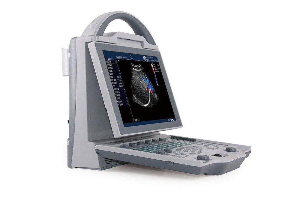 16GB Eingangsstufe-2D Laptop-Farb-Doppler-Ultraschall-System für Schwangerschaft