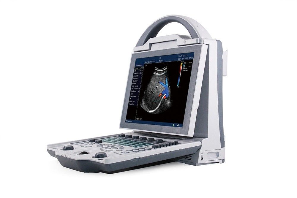 16GB Eingangsstufe-2D Laptop-Farb-Doppler-Ultraschall-System für Schwangerschaft
