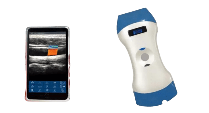 Drahtlose tragbare Ultraschallsonde mit 128 Elementen und zwei Köpfen – eine Sonde für Tiefenbildgebung, oberflächliche Bildgebung und Point-of-Care-Diagnose