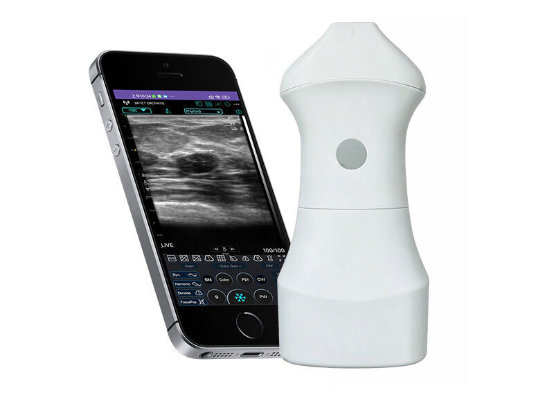 24-MHz-Hochfrequenz-Hautultraschallsonde für ästhetische Medizin, Dermatologie und injizierbare Verfahren