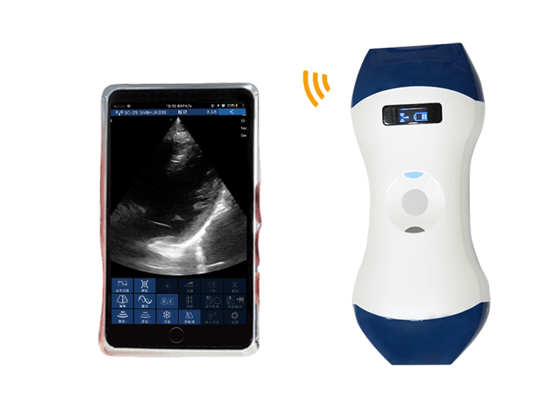 FDA CE ISO13485 handtellergroße drahtlose Hand-Ultraschallsonde mit Phased Array und linearem Doppelkopf für POCUS