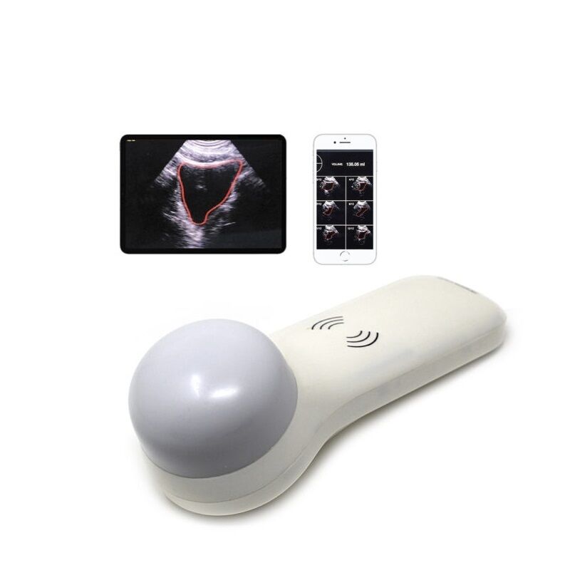 Drahtloser tragbarer 4D-Blasenscanner für die Urinvolumenmessung am Behandlungsort